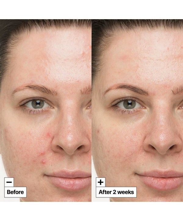 CICAPAIR SO SOOTHING TREATMENT